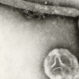 Le virus de la grippe aviaire H5N1 fait des ravages aux Etats-Unis, où plus de 30 millions de poules pondeuses ont été euthanasiées depuis le début de l'année (archives). KEYSTONE/AP CDC/CYNTHIA GOLDSMITH, JACKIE KATZ